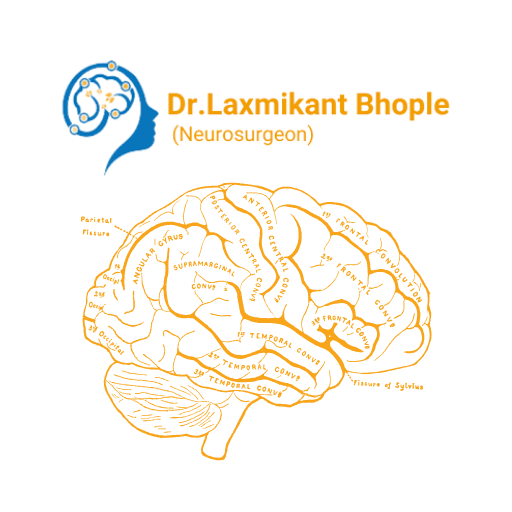 Neurovascular Treatment