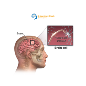 Epilepsy & Seizure Disorders