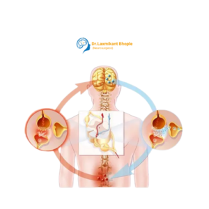 Neuropathic Pain Treatment