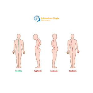 Spine Deformity Correction