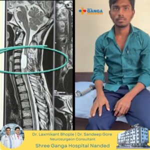 Cervical Neuroenteric Cyst (C4–C6 IDEM) Successfully Treated